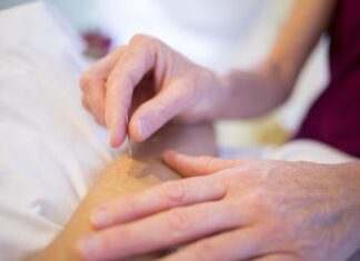 Acupuncture: 6 Reasons Why You Should Get It acupuncture, holistic healing, holistic